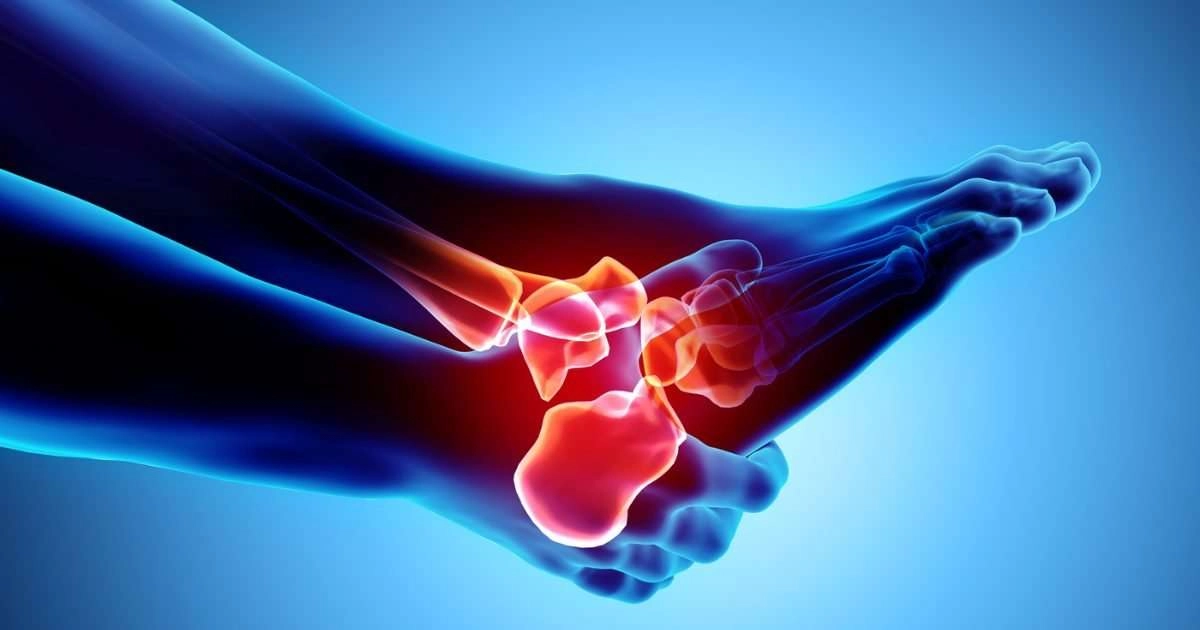 Heel pain 360 x-ray of foot with heel pain